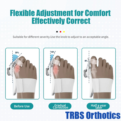 Corrector de estirador de tablillas de Bunion, alivio del dolor en los pies, tablillas Hallux Valgus proveedor